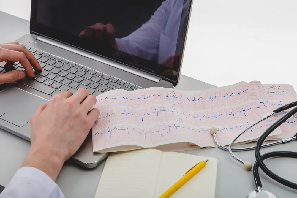 atrial fibrillation diagnosis